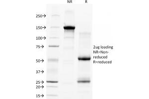 SDS-PAGE Analysis Purified CD28 Mouse Monoclonal Antibody (C28/77). (CD28 抗体)