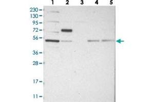 Western blot analysis of Lane 1: RT-4, Lane 2: U-251 MG, Lane 3: Human Plasma, Lane 4: Liver, Lane 5: Tonsil with CDCA7L polyclonal antibody  at 1:250-1:500 dilution. (CDCA7L 抗体)