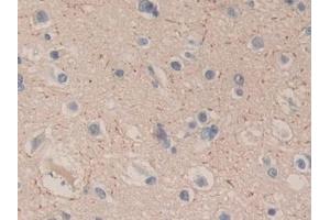 Immunohistochemistry (IHC) image for anti-Carboxypeptidase B1 (Tissue) (CPB1) (AA 111-417) antibody (ABIN7441961)