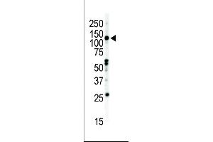 Western blot analysis of anti-EphB2 C-term Pab (ABIN391920 and ABIN2841730) in NCI- cell lysate. (EPH Receptor B2 抗体  (C-Term))