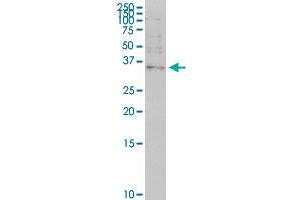 OTP monoclonal antibody (M03), clone 8E12. (OTP 抗体  (AA 11-120))