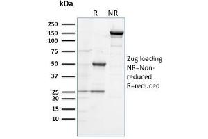 SDS-PAGE Analysis Purified CD284 Mouse Monoclonal Antibody (TLR4/230). (TLR4 抗体)