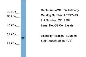 WB Suggested Anti-ZNF37A  Antibody Titration: 0. (ZNF37A 抗体  (Middle Region))