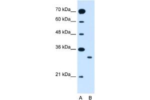 WB Suggested Anti-SLC25A22 Antibody Titration:  1. (SLC25A22 抗体  (N-Term))