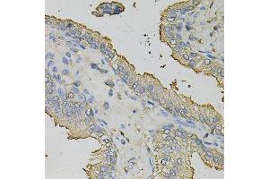 Immunohistochemistry of paraffin-embedded human prostate using AZGP1 Antibody (ABIN1876553) at dilution of 1:100 (40x lens). (AZGP1 抗体)
