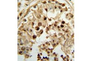 Immunohistochemistry analysis in formalin-fixed and paraffin-embedded human testis tissue reacted with 17-beta-HSD3 / HSD17B3 Antibody (Center) followed which was peroxidase conjugated to the secondary antibody, followed by DAB staining. (HSD17B3 抗体  (Middle Region))