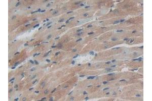 IHC-P analysis of Mouse Heart Tissue, with DAB staining. (TXNRD1 抗体  (AA 374-577))