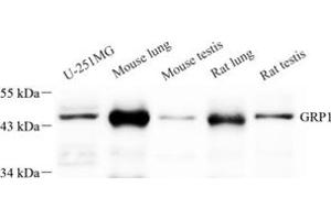 Western blot analysis of GRP1 (ABIN7073681) at dilution of 1: 250 (Cytohesin 3 抗体)
