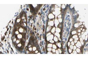 ABIN6278288 at 1/100 staining Rat colon tissue by IHC-P. (TMOD2 抗体  (N-Term))