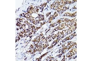 Immunohistochemistry (IHC) image for anti-Voltage-Dependent Anion Channel 2 (VDAC2) (AA 1-100) antibody (ABIN7271337)
