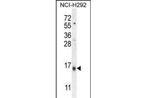 LY6G6C Antibody (C-term) (ABIN654496 and ABIN2844228) western blot analysis in NCI- cell line lysates (35 μg/lane). (LY6G6C 抗体  (C-Term))