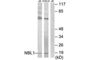 Western Blotting (WB) image for anti-Neuroblastoma 1, DAN Family BMP Antagonist (NBL1) (AA 131-180) antibody (ABIN2889475) (NBL1 抗体  (AA 131-180))