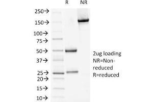 SDS-PAGE Analysis Purified DSG1 Mouse Monoclonal Antibody (18D4). (Desmoglein 1 抗体)