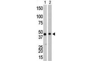 Western Blotting (WB) image for anti-Creatine Kinase, Brain (CKB) antibody (ABIN3002966) (CKB 抗体)