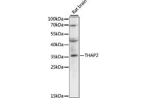 Western blot analysis of extracts of rat brain, using TH antibody (ABIN6133215, ABIN6149107, ABIN6149108 and ABIN6220276) at 1:3000 dilution. (THAP2 抗体  (AA 83-228))