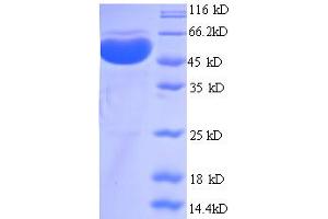SDS-PAGE (SDS) image for Protein Arginine Methyltransferase 1 (PRMT1) (AA 1-248), (partial) protein (GST tag) (ABIN5712271) (PRMT1 Protein (AA 1-248, partial) (GST tag))