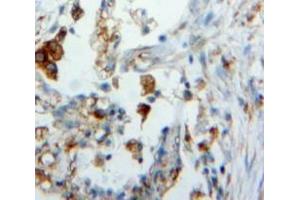 #VALUE! (Surfactant Protein C 抗体  (AA 24-197))