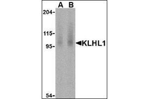 Western blot analysis of KLHL1 in human brain cell lysate with this product at (A) 2 and (B) 4 μg /ml. (KLHL1 抗体  (N-Term))