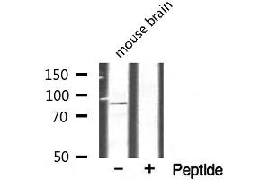 Western blot analysis of extracts from mouse brain, using CHSY1 antibody. (CHSY1 抗体  (Internal Region))
