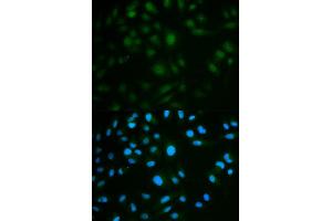 Immunofluorescence analysis of MCF7 cell using IL23R antibody. (IL23R 抗体)