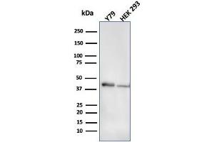 Western Blot Analysis of Y79 and HEK293 cell lysate using CKBB Mouse Monoclonal Antibody (CPTC-CKB-2). (CKB 抗体)