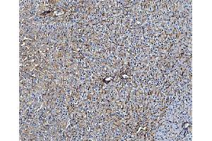 IHC analysis of TAPA1/CD81 using anti-TAPA1/CD81 antibody (ABIN5693258).