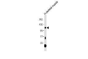 Anti-LGR5 Antibody (loop2) at 1:1000 dilution + Human skeletal muscle tissue lysate Lysates/proteins at 20 μg per lane. (LGR5 抗体  (AA 689-719))