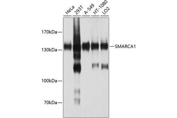SMARCA1 抗体  (AA 1-200)