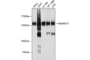 Western blot analysis of extracts of various cell lines, using SM antibody (ABIN6132562, ABIN6148098, ABIN6148099 and ABIN6214424) at 1:1000 dilution. (SMARCA1 抗体  (AA 1-200))