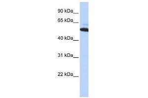 ATE1 antibody used at 1 ug/ml to detect target protein. (ATE1 抗体  (Middle Region))