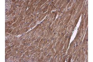 IHC-P Image ALDH7A1 antibody detects ALDH7A1 protein at cytoplasm in mouse heart by immunohistochemical analysis. (ALDH7A1 抗体)