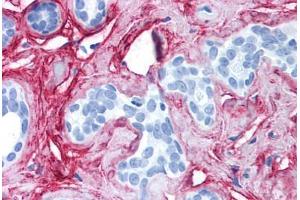 Human Breast (formalin-fixed, paraffin-embedded) stained with COL6A1 antibody ABIN214581 at 2. (COL6 抗体)