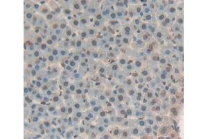 Used in DAB staining on fromalin fixed paraffin- embedded liver tissue (THYN1 抗体  (AA 1-226))