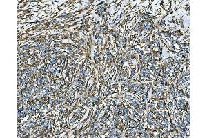 IHC analysis of RAB13 using anti-RAB13 antibody (ABIN7600599).