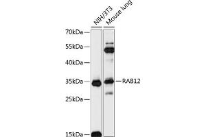Western blot analysis of extracts of various cell lines, using R antibody (ABIN7269796) at 1:3000 dilution. (RAB12 抗体  (AA 1-70))