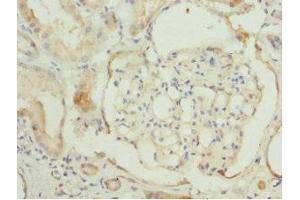 Immunohistochemistry of paraffin-embedded human kidney tissue using ABIN7171416 at dilution of 1:100