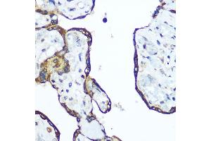Immunohistochemistry of paraffin-embedded human placenta using RhoA Rabbit pAb (ABIN6134426, ABIN6146932, ABIN6146933 and ABIN6218128) at dilution of 1:100 (40x lens). (RHOA 抗体  (C-Term))