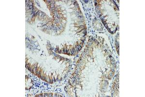 Anti-FER antibody, IHC(P) IHC(P): Rat Intestine Tissue (FER 抗体  (Middle Region))