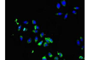 Immunofluorescent analysis of A549 cells using ABIN7169898 at dilution of 1:100 and Alexa Fluor 488-congugated AffiniPure Goat Anti-Rabbit IgG(H+L) (SMO 抗体  (AA 28-233))