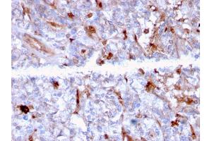 Formalin-fixed, paraffin-embedded human Kidney stained with C1QA Mouse Monoclonal Antibody (C1QA/2956). (C1QA 抗体  (AA 104-237))