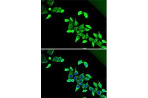 Immunofluorescence analysis of U2OS cells using CDK antibody (ABIN6131010, ABIN6138333, ABIN6138334 and ABIN6221451). (CDKAL1 抗体  (AA 1-230))