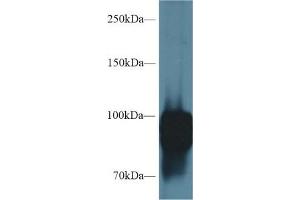 Western blot analysis of Rat Lung lysate, using Rat POSTN Antibody (1 µg/ml) and HRP-conjugated Goat Anti-Rabbit antibody ( (Periostin 抗体  (AA 659-810))
