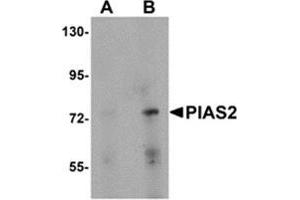 Western blot analysis of PIAS2 in rat brain tissue lysate with PIAS2 antibody at (A) 1 and (B) 2 μg/ml. (PIAS2 抗体  (N-Term))