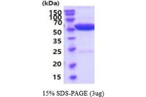 ALT Protein (AA 1-496) (His tag)