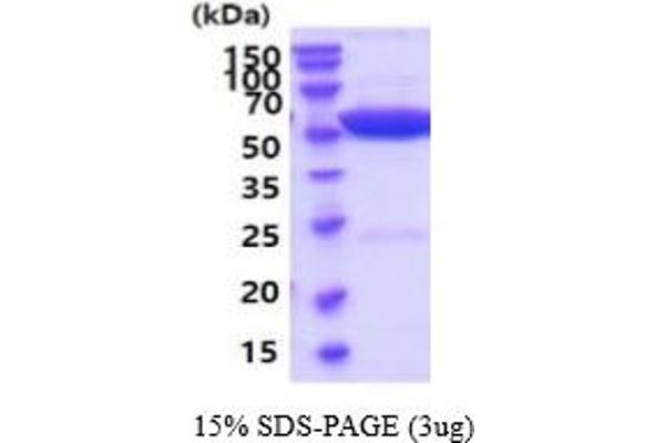ALT Protein (AA 1-496) (His tag)