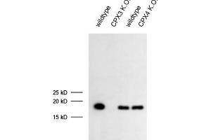 dilution: 1 : 1000 (ECL), sample: mouse retina extract (CPLX3 抗体)