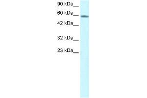 WB Suggested Anti-CHES1 Antibody Titration:  1. (FOXN3 抗体  (C-Term))