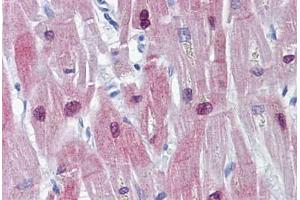 Human Heart: Formalin-Fixed, Paraffin-Embedded (FFPE) (HSPB6 抗体)