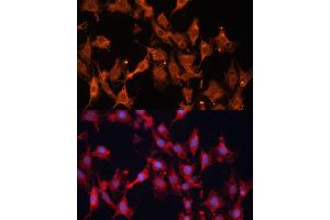 Immunofluorescence analysis of C6 cells using HSD17B1 Polyclonal Antibody (ABIN6129829, ABIN6142002, ABIN6142003 and ABIN6215013) at dilution of 1:100 (40x lens). (HSD17B1 抗体  (AA 1-328))