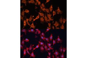 Immunofluorescence analysis of C6 cells using HSD17B1 Polyclonal Antibody (ABIN6129829, ABIN6142002, ABIN6142003 and ABIN6215013) at dilution of 1:100 (40x lens). (HSD17B1 抗体  (AA 1-328))